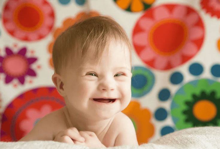 Síndrome de Down y los beneficios de elevar los niveles de&nbsp;glutatión